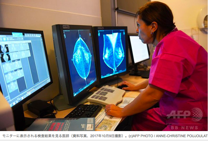 末期乳がん、免疫療法で完治　世界初の試験結果を発表
